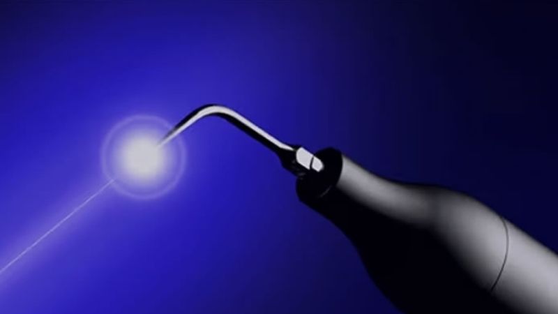 ブルーラジカル治療について ブルーラジカル治療について